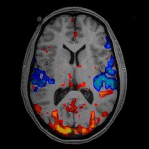 fMRI brain