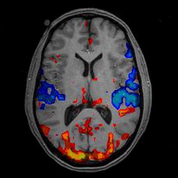 brain fmri scan