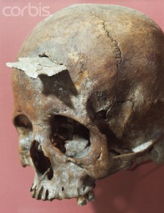 The skull of a Native American woman with a projectile point embedded in it.
