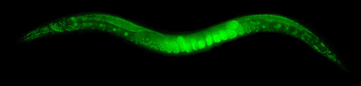 C. elegan expressing green-fluorescent proteins